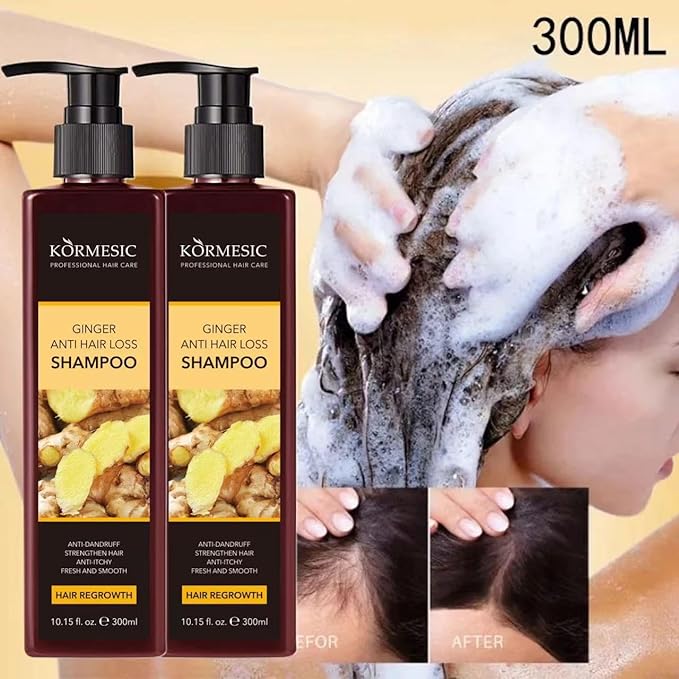 Šampon i Regenerator sa Đumbirom 1+1 GRATIS – Protiv Opadanja Kose, Za Brži Rast i Protiv Peruti